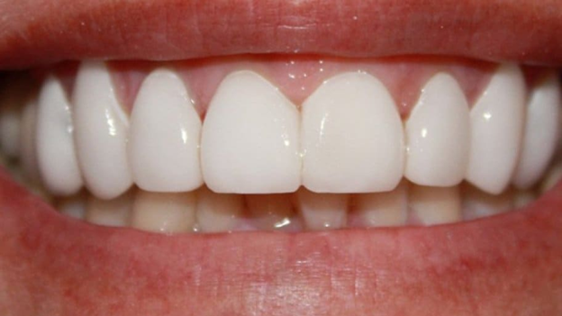 Popular Teeth & Gum Treatment Options with Dental Tourism
